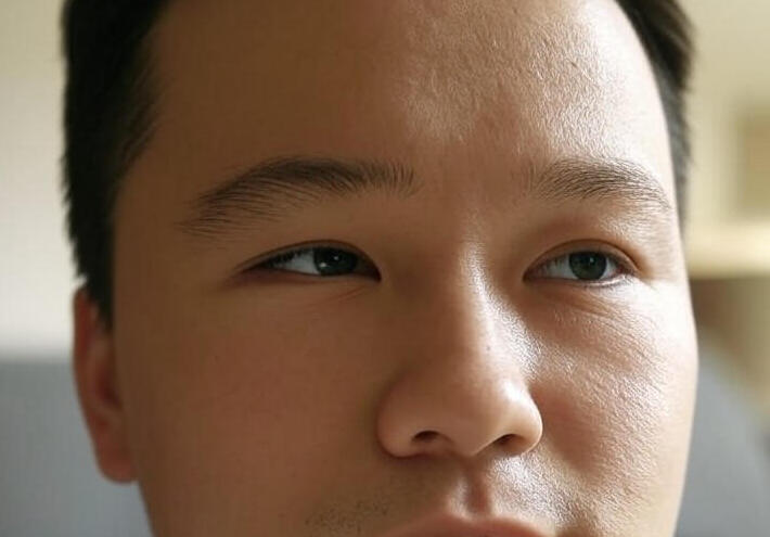 ما هي أسباب ارتعاش الجفن؟.. وما هي وطرق تخفيفه ؟